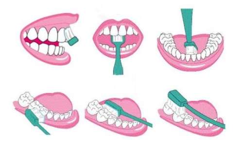 刷牙横竖有区别吗？差别究竟在哪里？